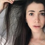 hair loss in teenagers